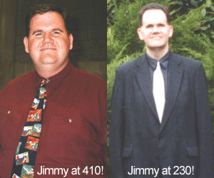 jimmybeforeafter jimmybeforeafter