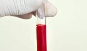 Blood sample