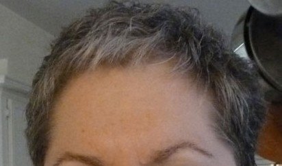 After treatment. Happily, the hair returned as did the eyebrows. Eyelashes are slowly re-emerging and laughter is part of my daily medicine.